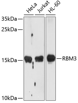 Western blot analysis of extracts of various cell lines using RBM3 Polyclonal Antibody at dilution of 1:1000.