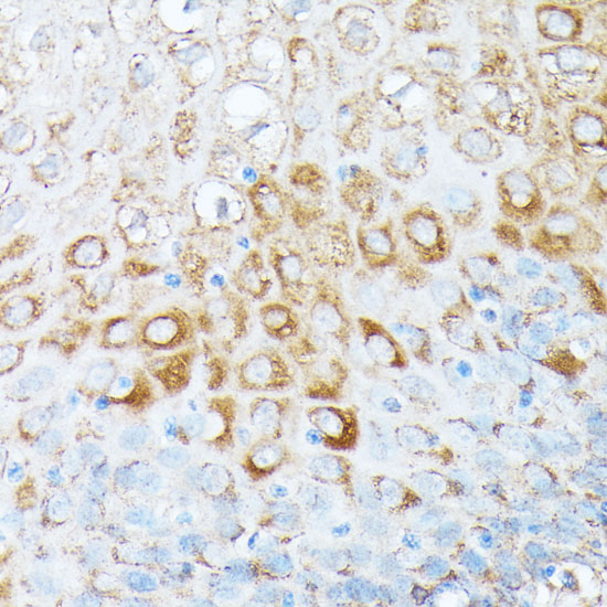 Immunohistochemistry of paraffin-embedded Human esophageal using RPL7 Polyclonal Antibody at dilution of  1:100 (40x lens).