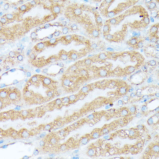 Immunohistochemistry of paraffin-embedded Mouse kidney using RPL7 Polyclonal Antibody at dilution of  1:100 (40x lens).