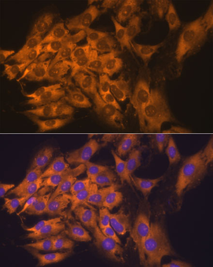 Immunofluorescence analysis of C6 cells using RPL17 Polyclonal Antibody at dilution of  1:100. Blue: DAPI for nuclear staining.