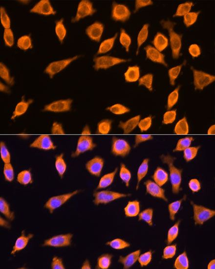 Immunofluorescence analysis of L929 cells using RPL17 Polyclonal Antibody at dilution of  1:100. Blue: DAPI for nuclear staining.