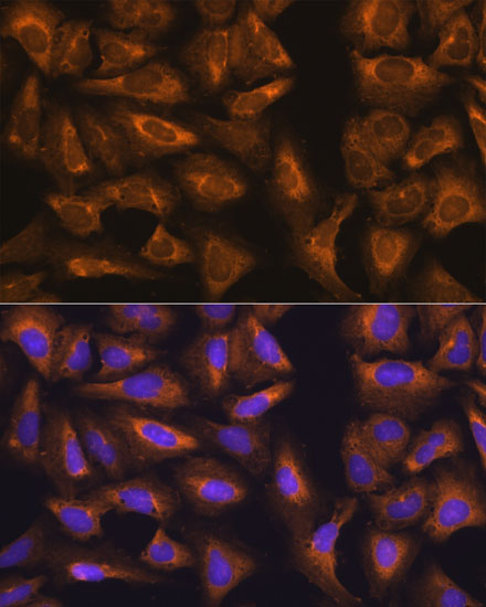 Immunofluorescence analysis of U-2 OS cells using RPL17 Polyclonal Antibody at dilution of  1:100. Blue: DAPI for nuclear staining.