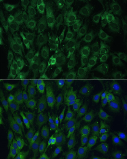 Immunofluorescence analysis of C6 cells using EIF3D Polyclonal Antibody at dilution of  1:100. Blue: DAPI for nuclear staining.