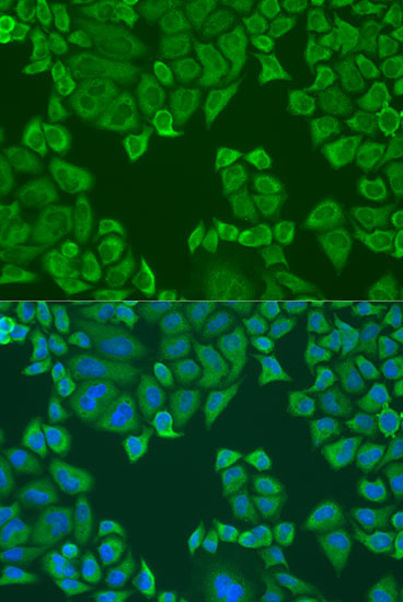 Immunofluorescence analysis of U2OS cells using Polyclonal AntibodyPC4 Polyclonal Antibody at dilution of  1:100. Blue: DAPI for nuclear staining.