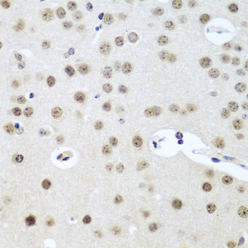 Immunohistochemistry of paraffin-embedded Mouse brain using UTP14A Polyclonal Antibody at dilution of  1:100 (40x lens).