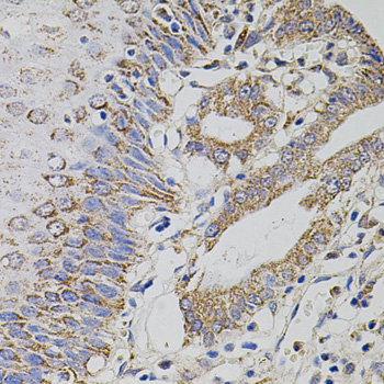 Immunohistochemistry of paraffin-embedded Human esophagus using TRMT2A Polyclonal Antibody at dilution of  1:100 (40x lens).