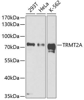 Western blot analysis of extracts of various cell lines using TRMT2A Polyclonal Antibody at dilution of 1:1000.