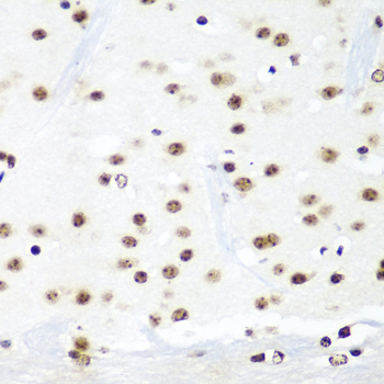 Immunohistochemistry of paraffin-embedded Mouse brain using HTATSF1 Polyclonal Antibody at dilution of  1:100 (40x lens).