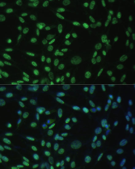 Immunofluorescence analysis of NIH-3T3 cells using ALYREF Polyclonal Antibody at dilution of  1:100 (40x lens). Blue: DAPI for nuclear staining.