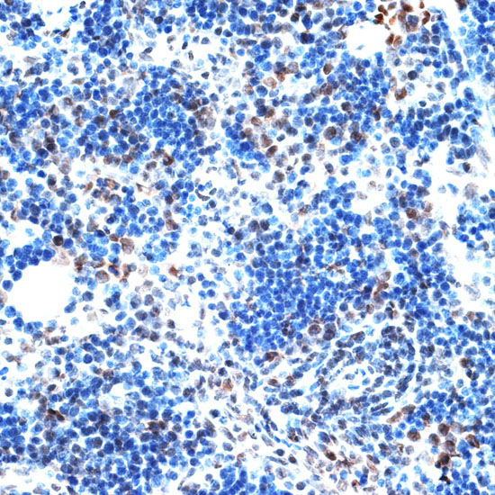 Immunohistochemistry of paraffin-embedded Rat spleen using AQR Polyclonal Antibody at dilution of  1:100 (40x lens).