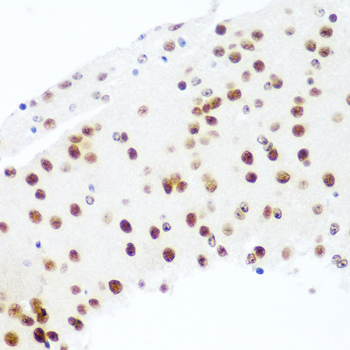 Immunohistochemistry of paraffin-embedded Mouse brain using Argonaute-2 Polyclonal Antibody at dilution of  1:100 (40x lens).