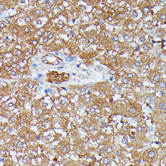 Immunohistochemistry of paraffin-embedded Rat liver using HDLBP Polyclonal Antibody at dilution of  1:100 (40x lens).