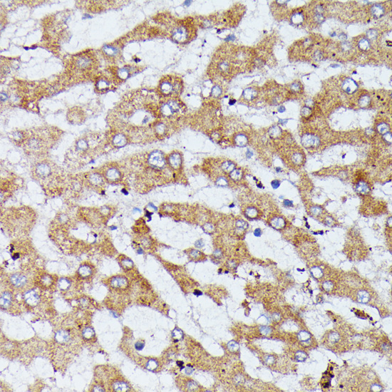 Immunohistochemistry of paraffin-embedded Human liver using HDLBP Polyclonal Antibody at dilution of  1:100 (40x lens).