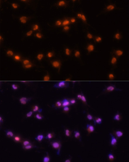 Immunofluorescence analysis of U-251MG cells using PRPF8 Polyclonal Antibody at dilution of  1:100 (20x lens). Blue: DAPI for nuclear staining.