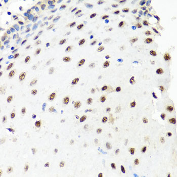 Immunohistochemistry of paraffin-embedded Human esophagus using PRPF8 Polyclonal Antibody at dilution of  1:100 (40x lens).