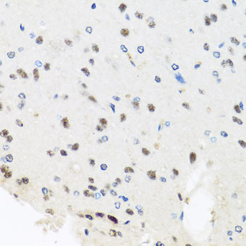 Immunohistochemistry of paraffin-embedded Rat brain using PRPF8 Polyclonal Antibody at dilution of  1:100 (40x lens).