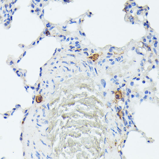 Immunohistochemistry of paraffin-embedded Rat lung using TIAL1 Polyclonal Antibody at dilution of  1:100 (40x lens).