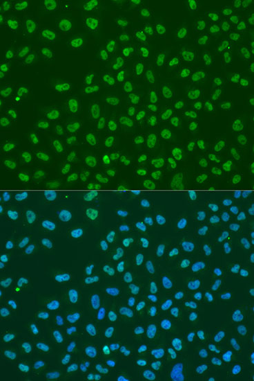 Immunofluorescence analysis of U2OS cells using HuR / ELAVL1 Polyclonal Antibody at dilution of  1:100. Blue: DAPI for nuclear staining.