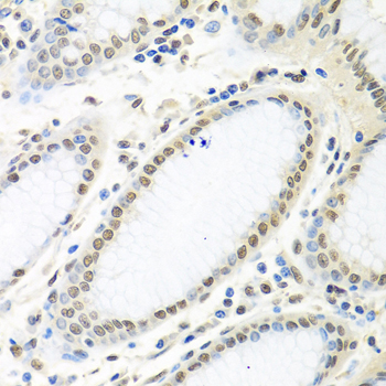 Immunohistochemistry of paraffin-embedded Human stomach using HuR / ELAVL1 Polyclonal Antibody at dilution of  1:100 (40x lens).