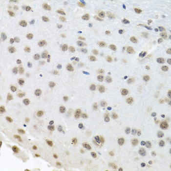 Immunohistochemistry of paraffin-embedded Mouse brain using HuR / ELAVL1 Polyclonal Antibody at dilution of  1:100 (40x lens).