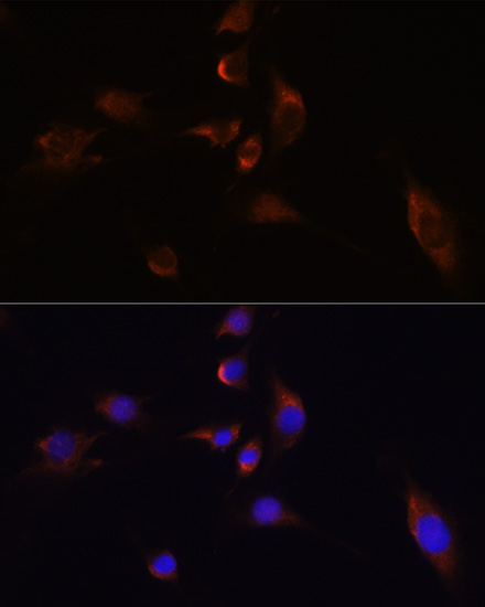 Immunofluorescence analysis of C6 cells using ELAVL3 Polyclonal Antibody at dilution of  1:100 (40x lens). Blue: DAPI for nuclear staining.