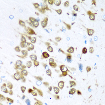 Immunohistochemistry of paraffin-embedded Rat brain using ELAVL3 Polyclonal Antibody at dilution of  1:200 (40x lens).