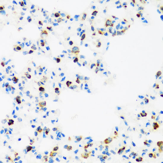 Immunohistochemistry of paraffin-embedded Rat lung using FMR1 Polyclonal Antibody at dilution of  1:100 (40x lens).