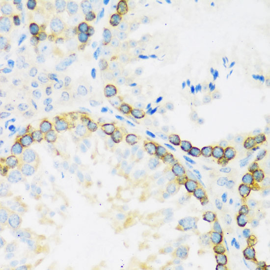 Immunohistochemistry of paraffin-embedded Mouse testis using FMR1 Polyclonal Antibody at dilution of  1:100 (40x lens).