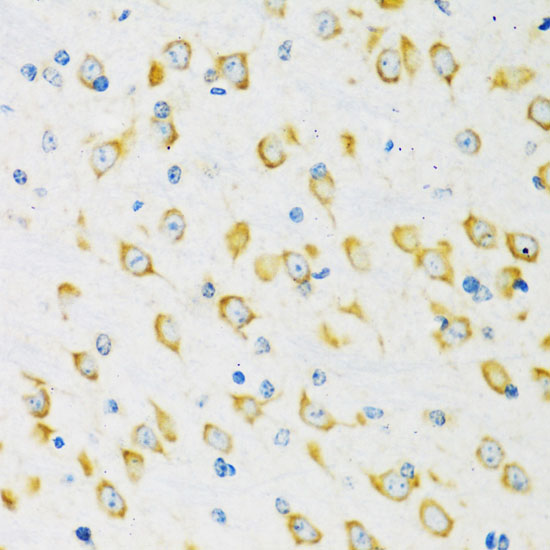 Immunohistochemistry of paraffin-embedded Mouse brain using FMR1 Polyclonal Antibody at dilution of  1:100 (40x lens).