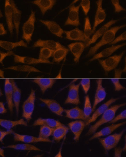 Immunofluorescence analysis of L929 cells using IGF2BP3 Polyclonal Antibody at dilution of  1:100. Blue: DAPI for nuclear staining.