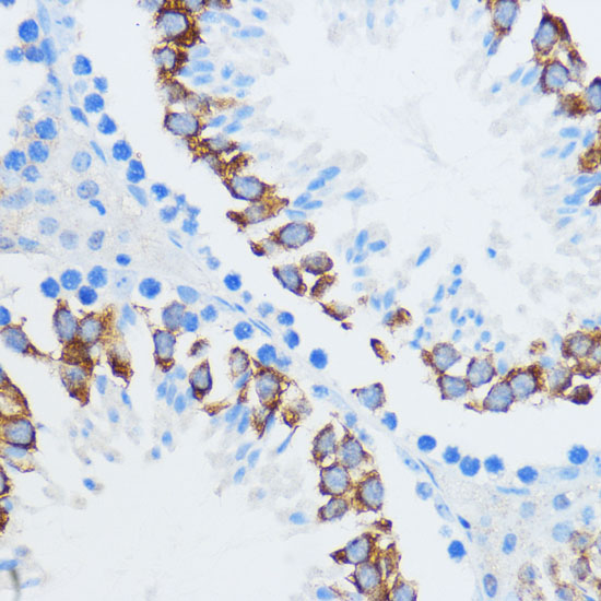 Immunohistochemistry of paraffin-embedded Mouse testis using IGF2BP3 Polyclonal Antibody at dilution of  1:100 (40x lens).