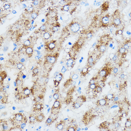 Immunohistochemistry of paraffin-embedded Human liver using IGF2BP3 Polyclonal Antibody at dilution of  1:100 (40x lens).