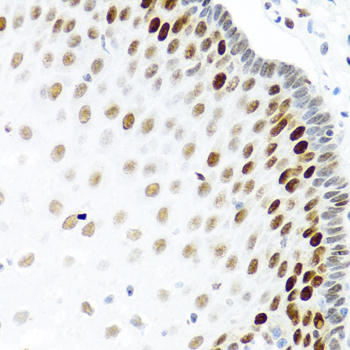 Immunohistochemistry of paraffin-embedded Human esophagus using KHDRBS2 Polyclonal Antibody at dilution of  1:100 (40x lens).