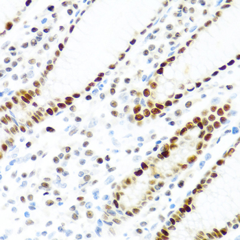 Immunohistochemistry of paraffin-embedded Human stomach using KHDRBS2 Polyclonal Antibody at dilution of  1:100 (40x lens).