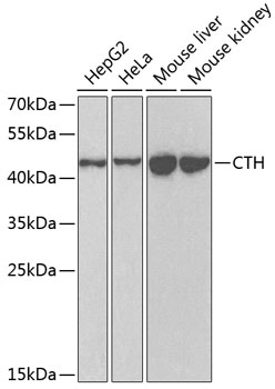 Western blot analysis of extracts of various cell lines using CTH Polyclonal Antibody at dilution of 1:1000.