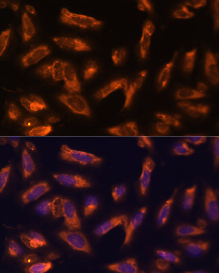 Immunofluorescence analysis of U-2 OS cells using CSF2 Polyclonal Antibody at dilution of  1:100. Blue: DAPI for nuclear staining.