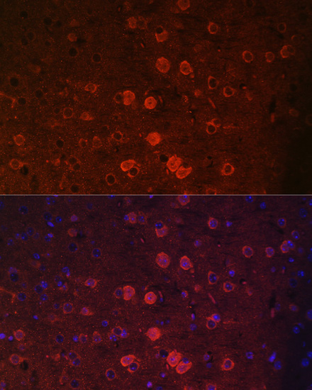 Immunofluorescence analysis of Mouse brain using TRPM2 Polyclonal Antibody at dilution of  1:100. Blue: DAPI for nuclear staining.