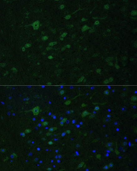 Immunofluorescence analysis of Mouse brain using KMT2E Polyclonal Antibody at dilution of  1:100. Blue: DAPI for nuclear staining.