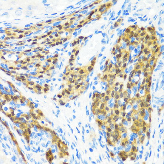 Immunohistochemistry of paraffin-embedded Rat ovary using KMT2E Polyclonal Antibody at dilution of  1:200 (40x lens).