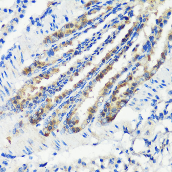 Immunohistochemistry of paraffin-embedded Mouse lung using KMT2E Polyclonal Antibody at dilution of  1:200 (40x lens).