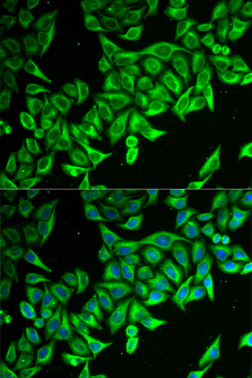 Immunofluorescence analysis of MCF-7 cells using DAP Polyclonal Antibody