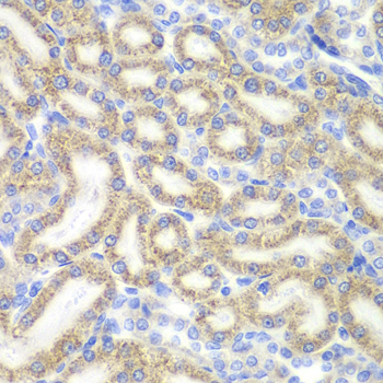 Immunohistochemistry of paraffin-embedded Rat kidney using DAP Polyclonal Antibody at dilution of  1:200 (40x lens).