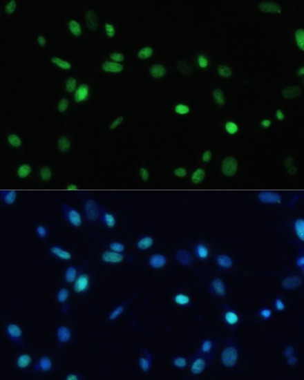 Immunofluorescence analysis of NIH-3T3 cells using SET Polyclonal Antibody at dilution of  1:100. Blue: DAPI for nuclear staining.