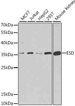 Western blot analysis of extracts of various cell lines using ESD Polyclonal Antibody at dilution of 1:1000.