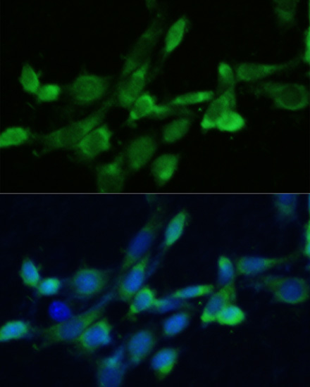 Immunofluorescence analysis of NIH-3T3 cells using FDFT1 Polyclonal Antibody at dilution of  1:100. Blue: DAPI for nuclear staining.