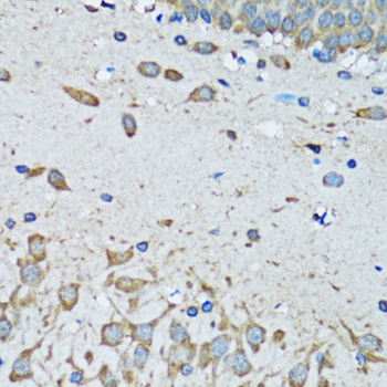 Immunohistochemistry of paraffin-embedded Mouse brain using FDFT1 Polyclonal Antibody at dilution of  1:100 (40x lens).