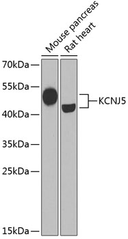 Western blot analysis of extracts of various cell lines using KCNJ5 Polyclonal Antibody at dilution of 1:1000.