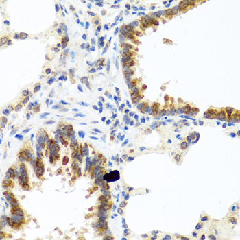 Immunohistochemistry of paraffin-embedded Rat lung using C8orf4 Polyclonal Antibody at dilution of  1:100 (40x lens).