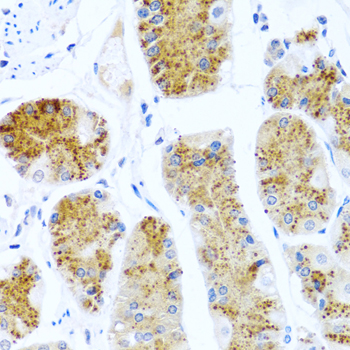 Immunohistochemistry of paraffin-embedded Human stomach using C8orf4 Polyclonal Antibody at dilution of  1:100 (40x lens).