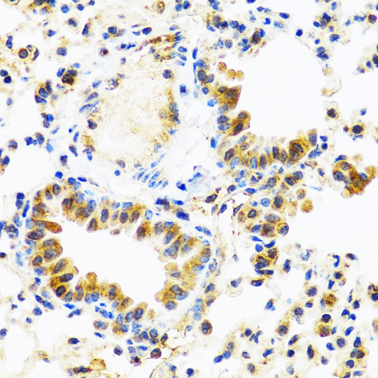 Immunohistochemistry of paraffin-embedded Mouse lung using C8orf4 Polyclonal Antibody at dilution of  1:100 (40x lens).